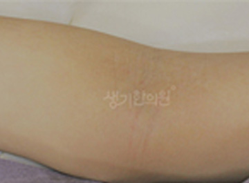 피부건강설계, 생기한의원 난치성 피부질환을 진심으로 치료해온 시간 20년